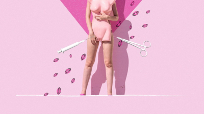 Интимная пластика для женщин