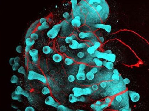 Культивируемая клетка кожи человека