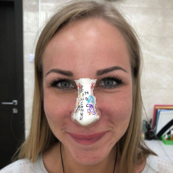 ринопластика Стайсупов Санкт-Петербург