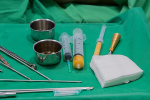 Будет ли эффект от липотрансфера постоянным?