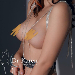 От мысли до операции 8 лет: моя история увеличения груди	