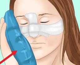 Как скрыть синяки после пластической операции?