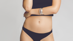 Лечение рубцов после подтяжки живота