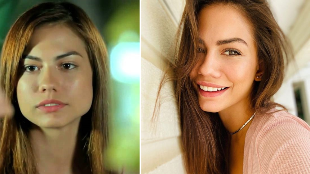 Демет Оздемир до и после пластических операций