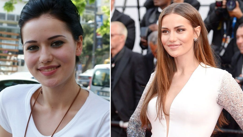 Фахрие Эвджен до и после пластических операций