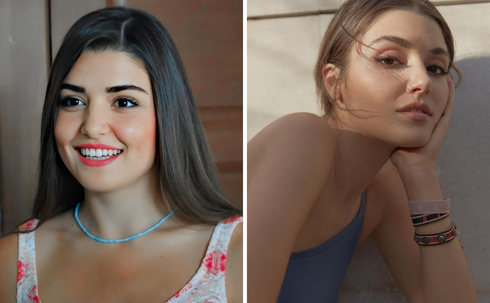 Ханде Эрчел до и после пластических операций