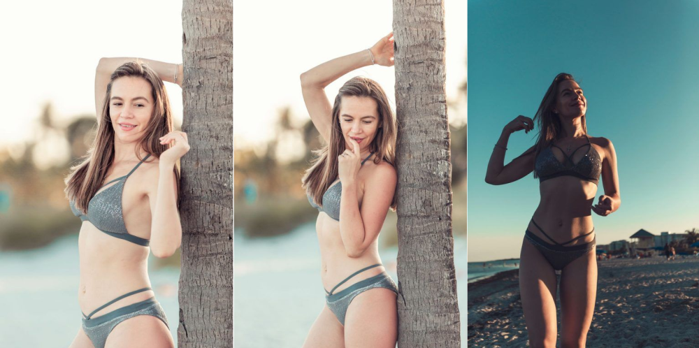 Пациентка после увеличения груди у доктора Носовой