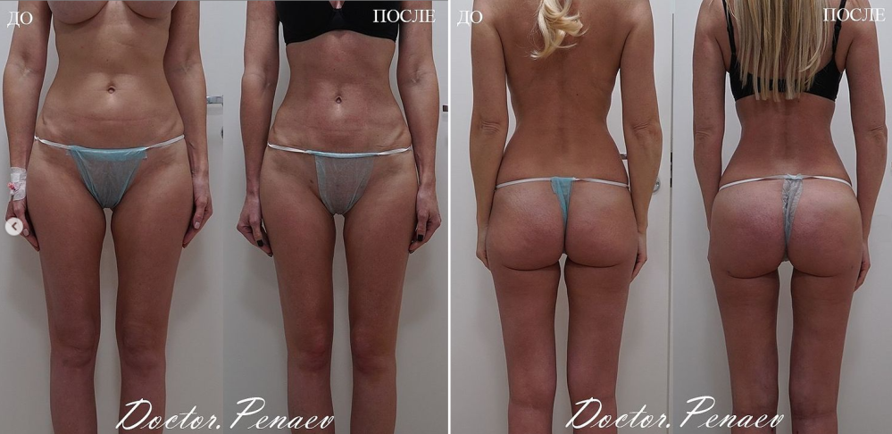 Пациентка пластического хирурга Арслана Пенаева