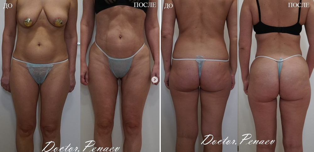 Пациентка пластического хирурга Арслана Пенаева