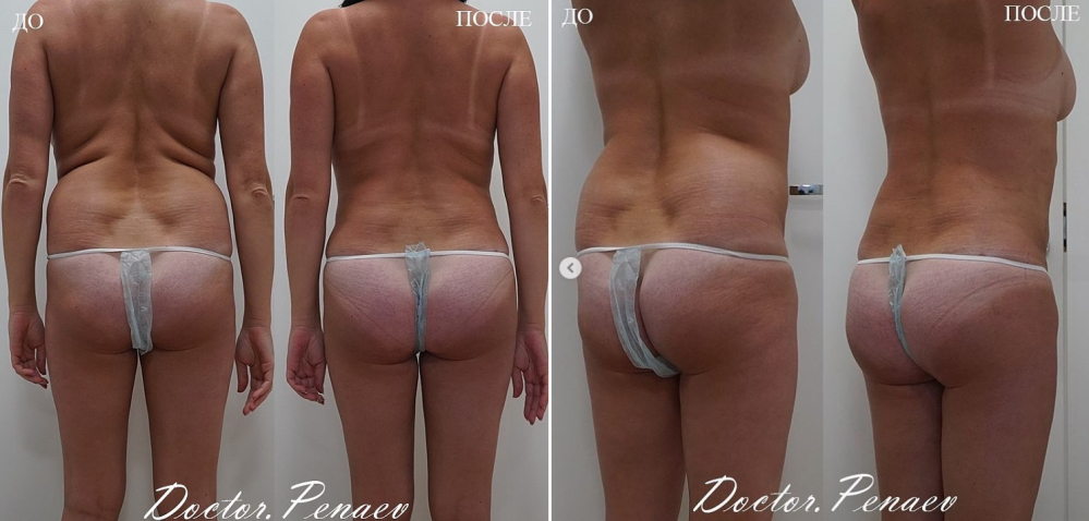 Пациентка пластического хирурга Арслана Пенаева