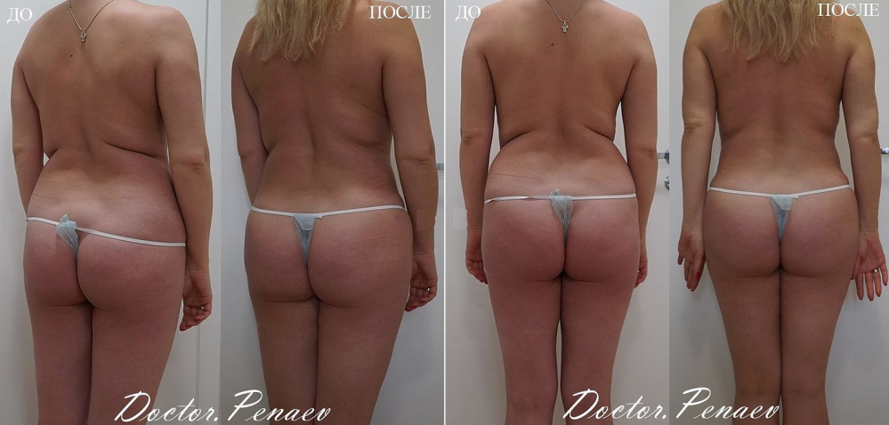 Пациентка пластического хирурга Арслана Пенаева