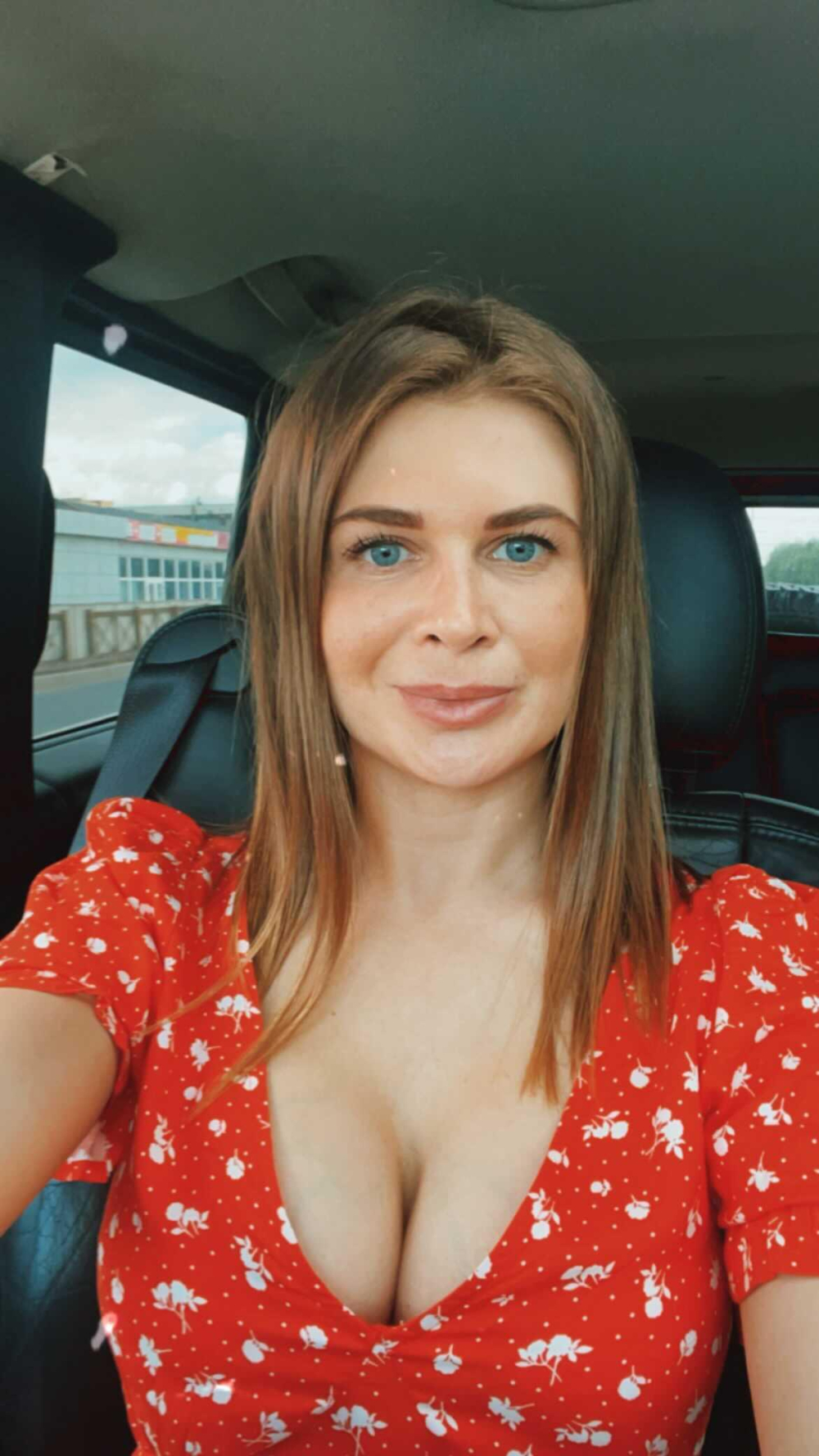 Пациентка доктора Станислава Екимова после увеличения груди