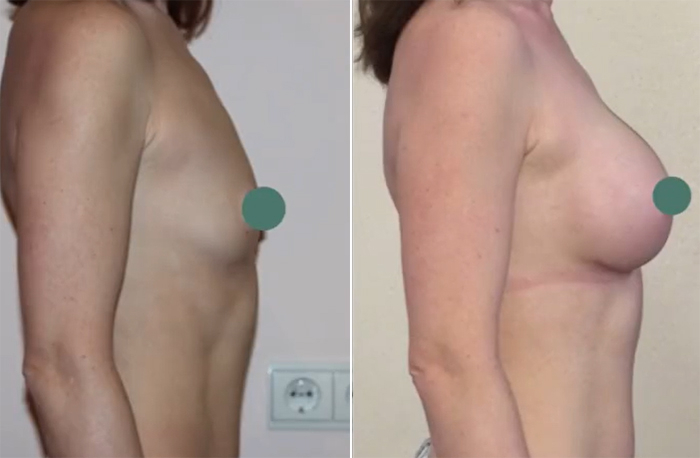 Natural Beauty патент