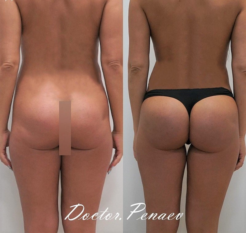 Пациентка доктора Арслана Пенаева.