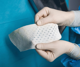 Имплант из чешуи трески, произведенный компанией Kerecis