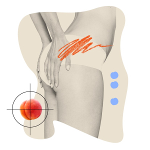 Липофилинг ягодиц