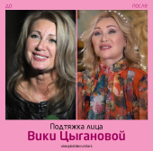 Вика Цыганова до и после пластики