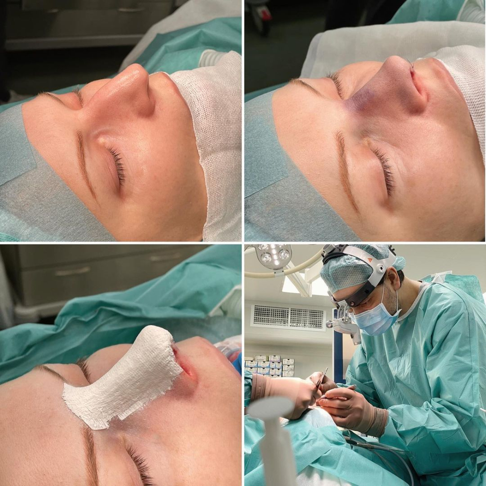 Пластический хирург Валерий Стайсупов