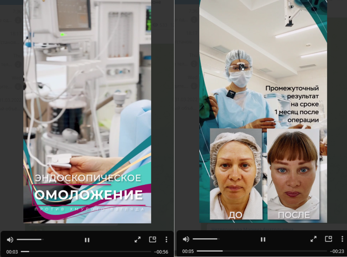 Видеоролики доктора Четвериковой из операционной