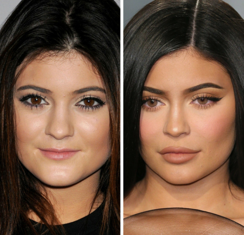 Кайли Дженнер