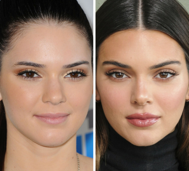  Кендалл Дженнер