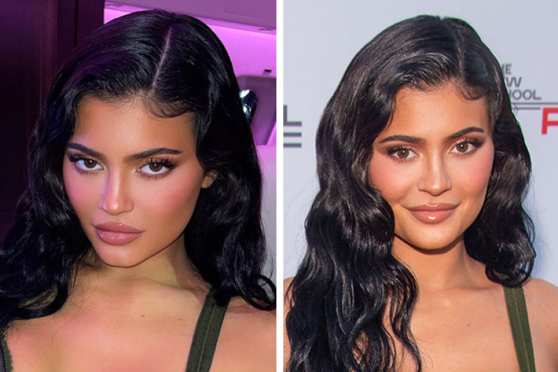 Поклонники вновь заговорили о пластике Кайли Дженнер