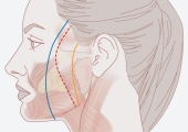 SMAS лифтинг – операция по подтяжке лица