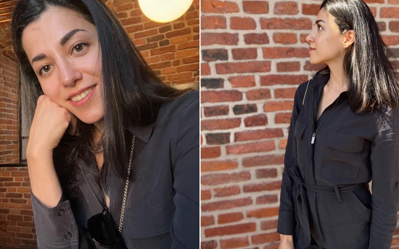 Фотоотзыв пациентки пластического хирурга Валерия Стайсупова после ринопластики.