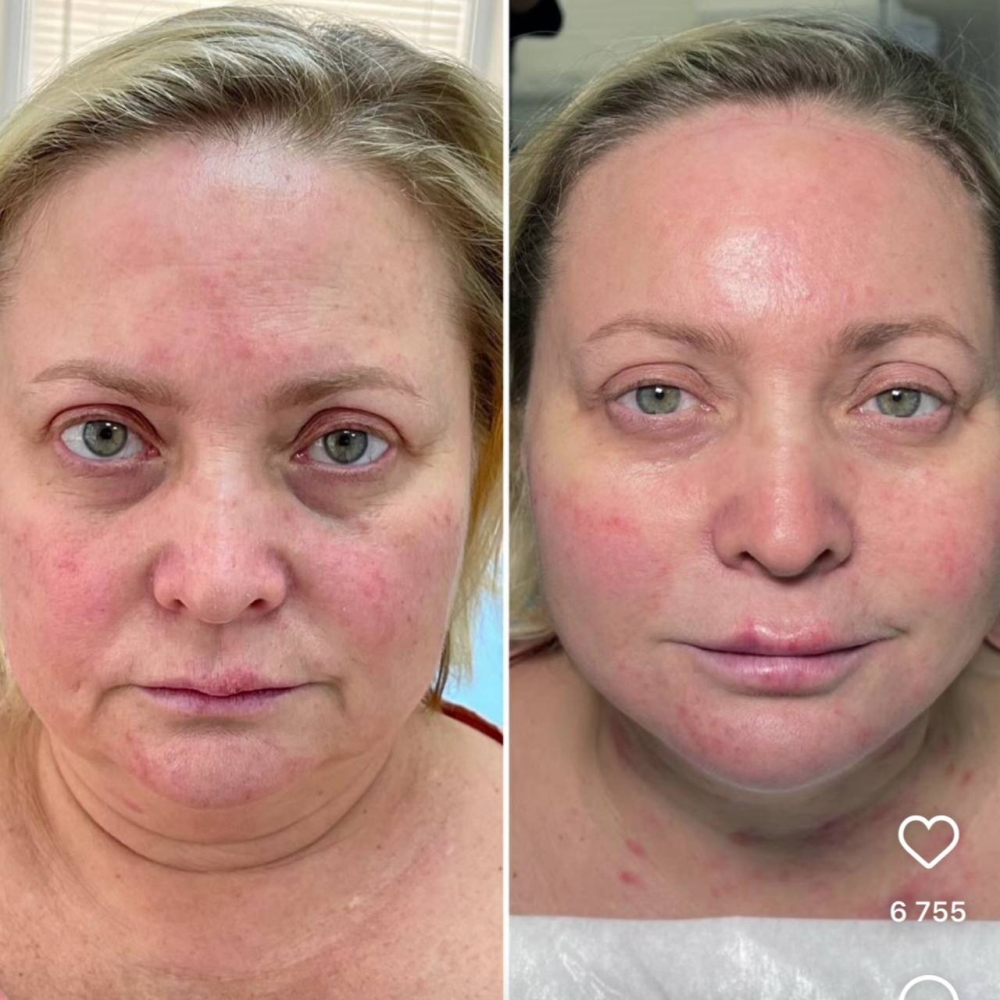 Светлана Пермякова помолодела лицом!