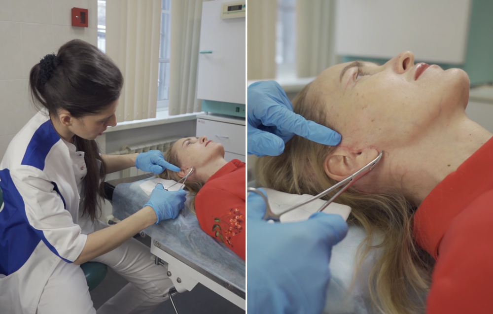 Пластический хирург Ольга Ованесова и пациентка. Доктор снимает швы после подтяжки лица