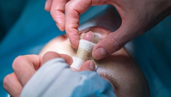 Ринопластика для коррекции кривого носа