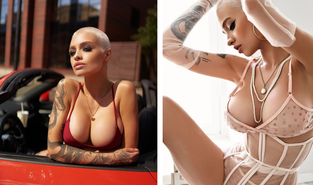 Пациентка пластического хирурга Гукаса Миракяна после операции по увеличению груди имплантами. Фотоотзыв