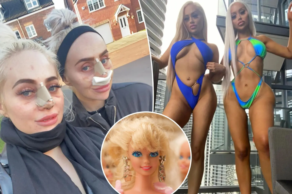 Жительницы Великобритании Дейзи и Долли Симпсон