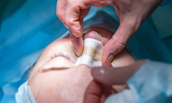 Почему ринопластика иногда слишком заметна?