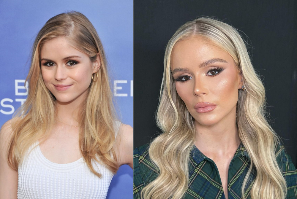 Эрин Мориарти до и после пластики лица