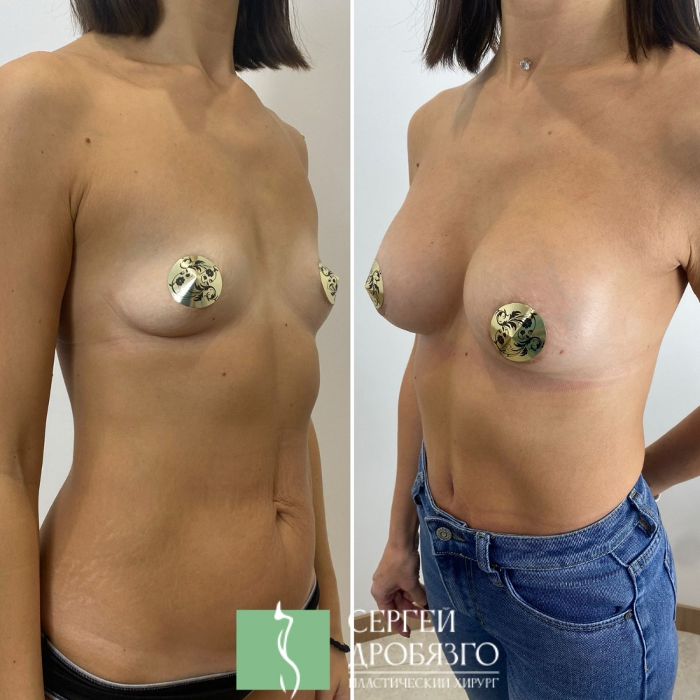 Комплексные пластические операции. Сергей Владимирович Дробязго