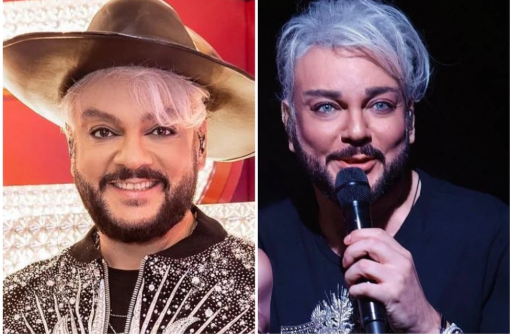 Пластика лица у Филиппа Киркорова