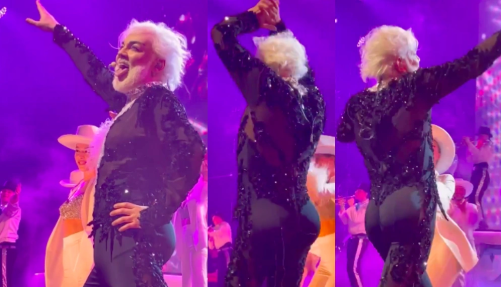 Увеличение ягодиц Филиппа Киркорова