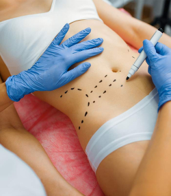  Липолитики: за и против