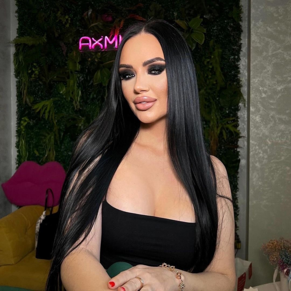 Пациентка доктора Гукаса Миракяна до и после увеличения груди имплантами