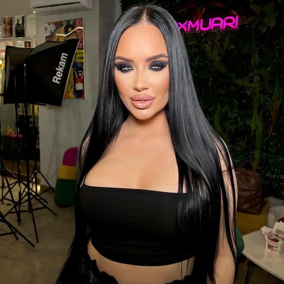 Пациентка доктора Гукаса Миракяна до и после увеличения груди имплантатами