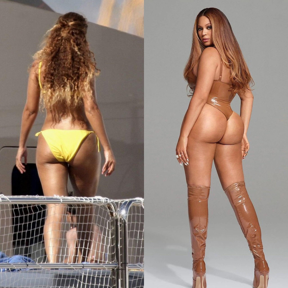 Увеличение ягодиц Бейонсе