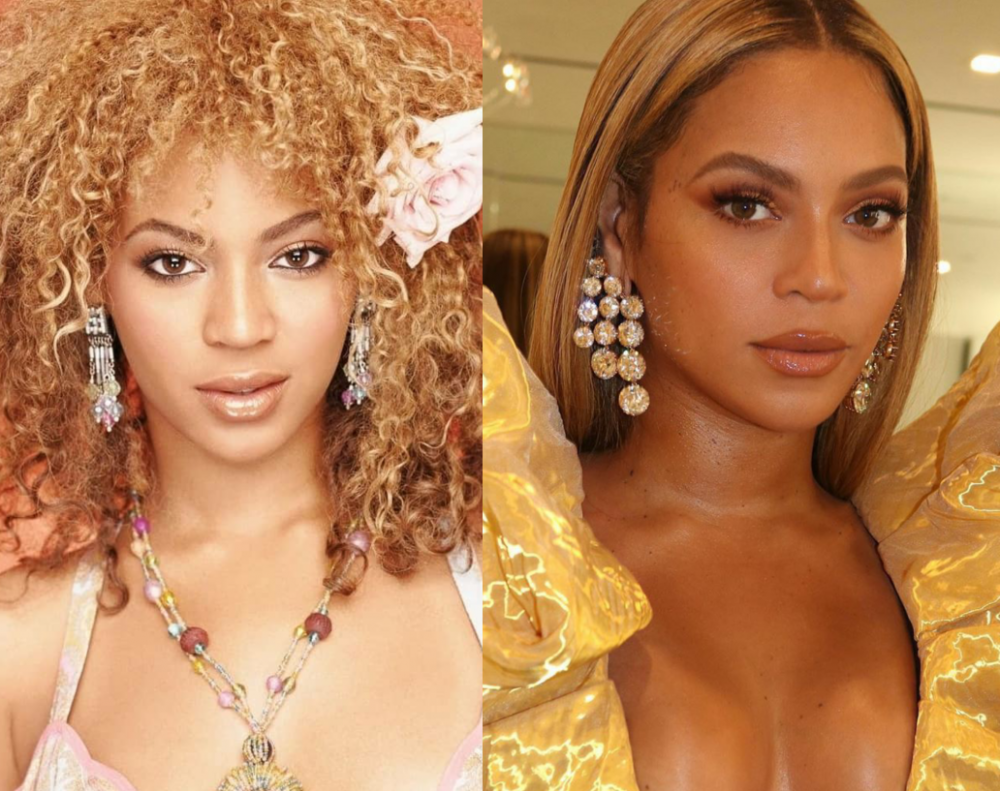 Ринопластика Бейонсе