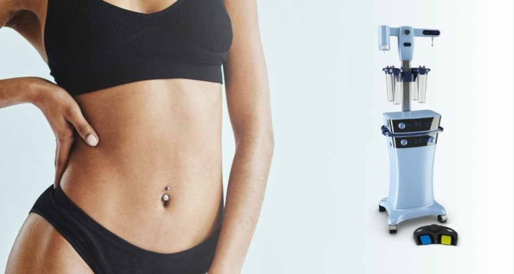 3D High Definition VASER-липосакция