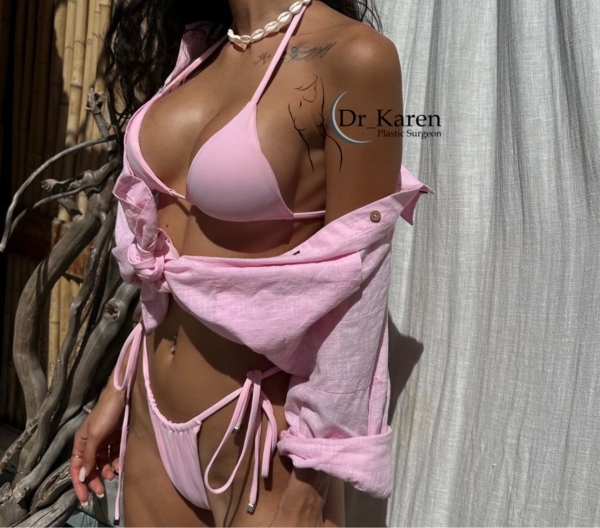 Пациентка пластического хирурга Карена Пайтяна после увеличения груди. Фотоотзыв