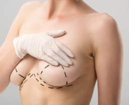 Шрамы от подтяжки груди останутся через год?