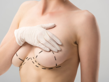 Шрамы от подтяжки груди останутся через год?