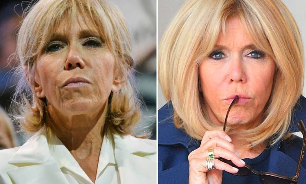 Брижит Макрон до и после омоложения лица