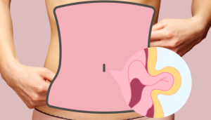 Как избавиться от грыжи и вернуть красоту живота? Читайте об экспертной методике, которая помогает решить обе задачи за одну операцию.