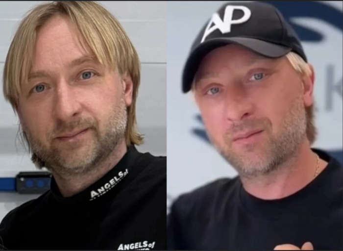 Евгений Плющенко до и после операции у Тимура Хайдарова